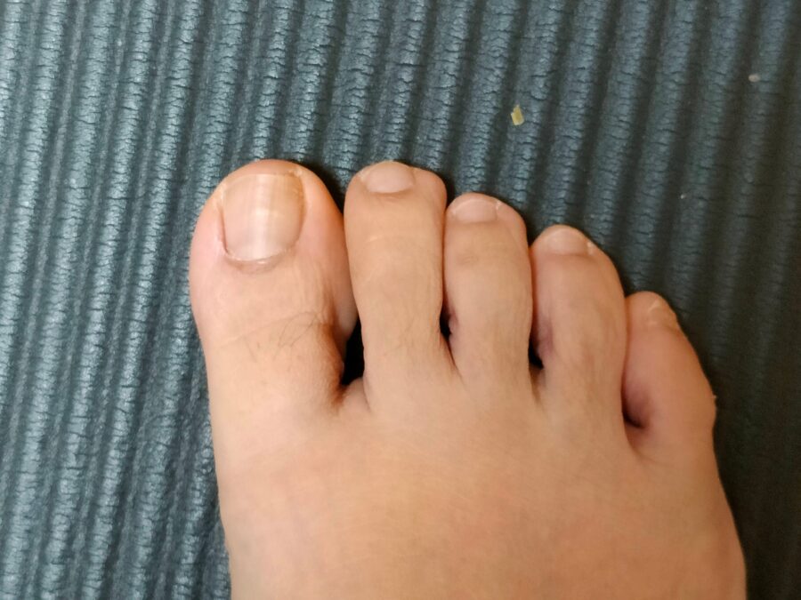 足の指